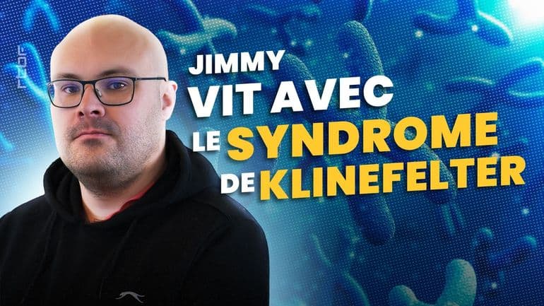 Jimmy est atteint du syndrome de Klinefelter : "On développe des caractéristiques physiques des deux sexes"